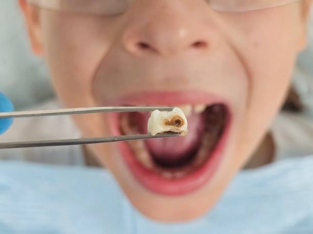 Best Emergency Dental Care for Trauma or Injury in Kahoka, MO